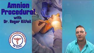 Amnionic membrane placed in Ganglion Excision Revision | Podiatry Explained by Dr. Roger Kilfoil