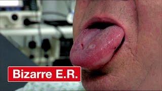 Man Swallows Wasp And Gets Stung On Tongue - Bizarre ER