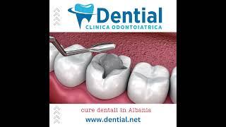 DENTIAL | cure dentali e dentisti in Albania