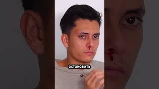 Как быстро остановить носовое кровотечение: простые и эффективные советы #факты