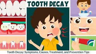 Tooth Decay: Symptoms, Causes, Treatment, and Prevention | Video for Kids | Learning Junction