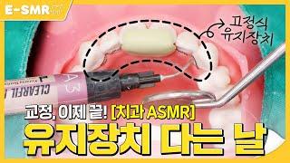 교정 언제 끝나요? 곧 끝나요~ 이제 유지장치를 붙여보아요! [치과 ASMR]