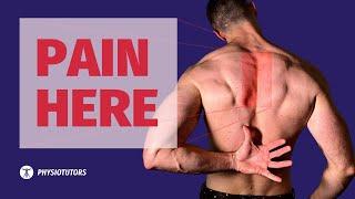 Rhomboid pain / interscapular pain / pain between the shoulder blades