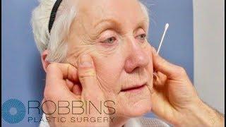 " Best of Nashville" Winner - Nashville Plastic Surgeon- CAN YOU FIX SOMEONE ELSE"S FACELIFT?
