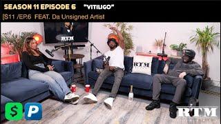 Da Unsigned Artist “I DIDN’T GRASS ON MY MUM, ARE YOU MAD?RTM Podcast Show S11 Ep6 (Vitiligo)