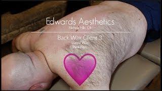 Edwards Aesthetics | Back Wax | Client 3 | Starpil Pink |