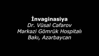 Invaginasiya Uşaq Cərrahiyyəsi və Urologiyası uzmanı Op. Dr. Vüsal Cəfərov