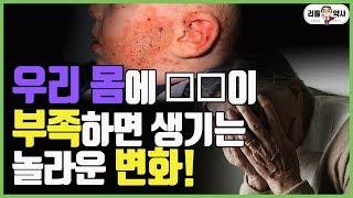 [1편] 당뇨, 치매, 아토피..우리가 놓치고 있었던 이것! 아연의 효능