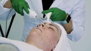 High Frequency Facial Treatment