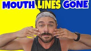 Quickly Get Rid of Smile & Laugh Lines Without Surgery? | Chris Gibson