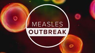 146 measles cases reported in West Texas