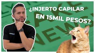 Precio Injerto Capilar MÉXICO 