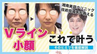 【若返り・小顔ドクター】外科医歴25年の早田医師が徹底解説！理想に合った糸リフトが見つかる