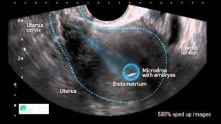 INSTITUT MARQUÈS - The uterus moves the embryos for their correct implantation