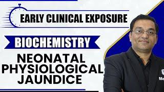 Neonatal Physiological Jaundice: Biochemistry | 1st Year MBBS | Early Clinical Exposure | Dr. Rajesh