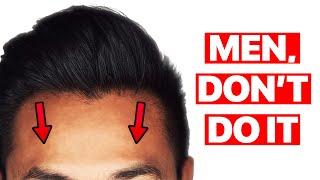 Why Hairline Lowering is NOT for Men!