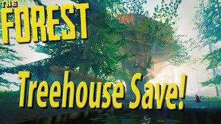 ►Our Treehouse Villa! Base Showcase / Save File Share [Hard Mode]  | The Forest
