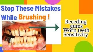 3 most common mistakes that needs to be STOPPED | Prevent Receding gums , Sensitivity , Worn teeth