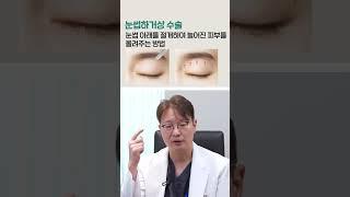 처진 눈 해결 방법 3가지 #shorts