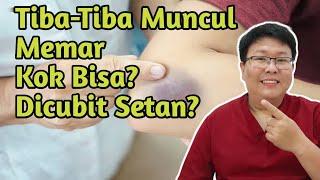 Tiba-Tiba Muncul Memar? Karena Dicubit Setan?