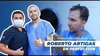 Trasplante capilar de Roberto Artigas