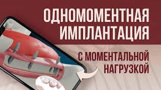 Не бойтесь УДАЛЯТЬ ЗУБЫ! Одномоментная имплантация РЕШИТ ПРОБЛЕМУ ЗА ОДИН ВИЗИТ.