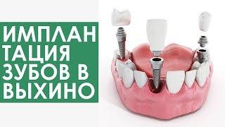 Имплантация зубов -  как это происходит в ПрезиДЕНТ Выхино