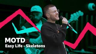 Easy Life – Skeletons (MOTDx)