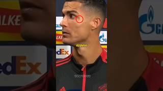 RONALDO'NUN YÜZÜNDEKI YARA İZİ NEDEN VAR  #shorts #short #football #ronaldo