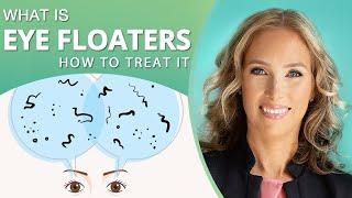 What Are Eye Floaters | How to Treat Eye Floaters Naturally | Dr. J9 Live