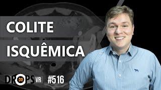 COLITE ISQUÊMICA: QUANDO PENSAR? / VOCÊ RADIOLOGISTA