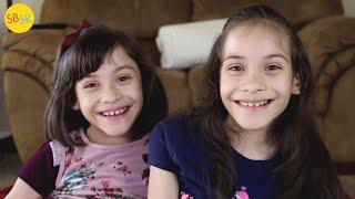 Conjoined Twins Who Were Separated (A Miraculous Story)