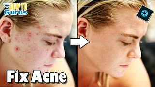 From Blemished to Beautiful: Master Acne SKIN RETOUCHING in Photoshop Elements