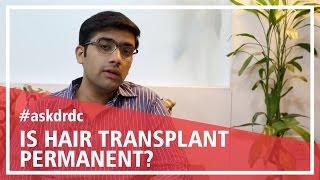 Is Hair Transplant Permanent in Male Pattern Baldness | HairMD, Pune.