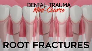 Dental Trauma Mini-Course - Part 6 - Dental Trauma Guide - Root Fractures