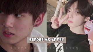 Jungkook’s Secret Skin Care Tips To Remove Acne & Pimples & get Clear Skin in 1 Month !