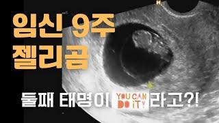 [시험관 둘째기록] 임신 8주/ 둘째 태명 공개합니다!