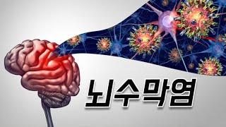 수막구균 접종 해야하나요?
