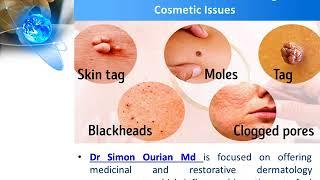 Dr Simon Ourian Md   Help With Skin, Hair, Or Nail Issues That Impact Our Patients' With Excellence