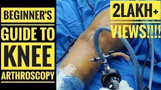 Beginner's Guide to Knee Arthroscopy