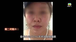 東張西望 -   整容隨時整出禍