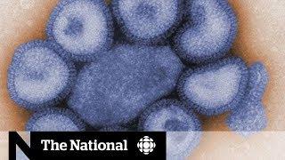 Bad flu season catches hospitals off guard