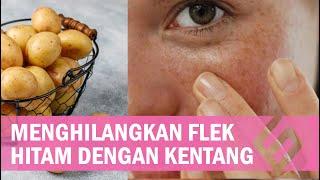 Cara Menghilangkan Flek Hitam dengan Kentang, Ada 3 Metode