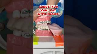 3 BEST and WORST HALLOWEEN CANDY for BRACES / TEETH  #braces #candy #crunchy