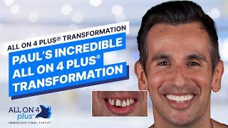 Our Most DRAMATIC Smile Transformation Yet!