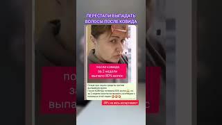 Как остановить выпадения волос после ковида