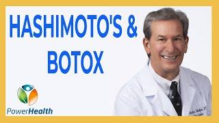 Hashimoto's and Botox