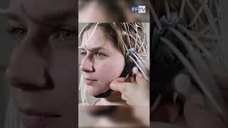 ЛЕЧЕНИЕ ЭПИЛЕПСИИ #здоровье #медицина #эпилепсия #лечение #фондфилатова #shorts #долголетие