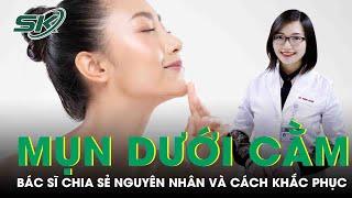 Nguyên Nhân Gây Mụn Dưới Cằm Và Cách Khắc Phục | SKĐS