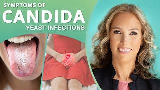 Symptoms of Candida  | Yeast Infections | Dr. J9 Live